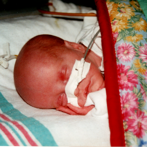 Lena as a Baby in NICU